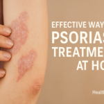 Effective Ways for Psoriasis Treatments at Home